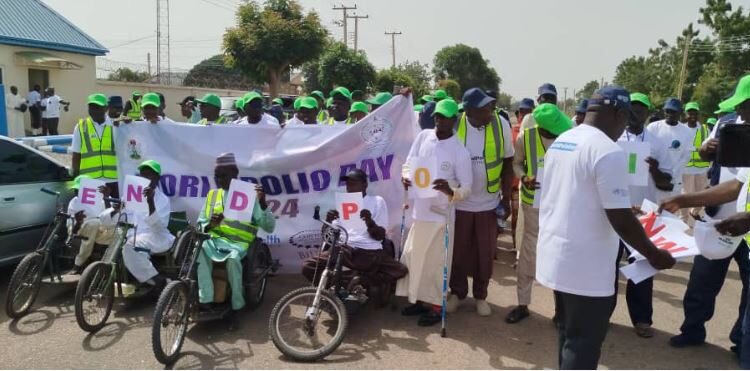 We Do Not Want To See Anyone With Polio Disease Any More – Yobe State Govt