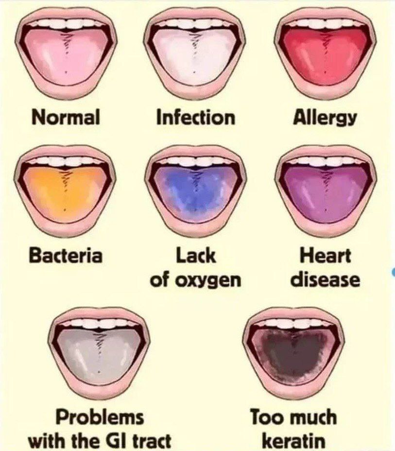 The color of your tongue can reveal a lot about your overall health. Here are some general insights: