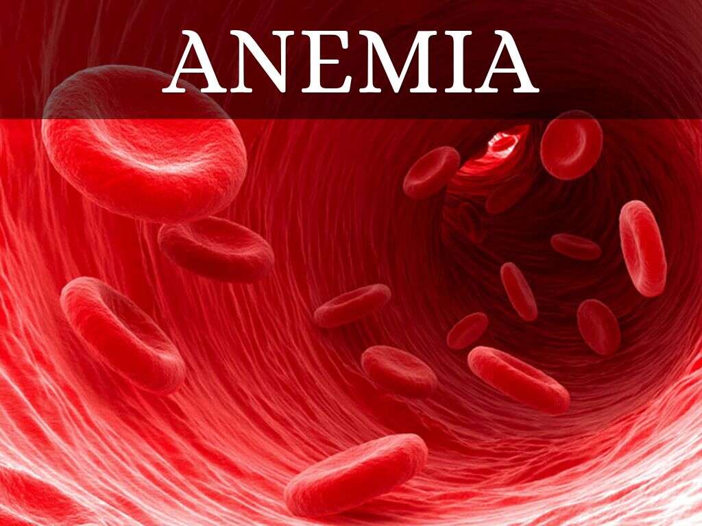 Anemia